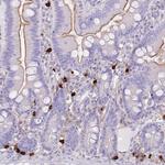 TPSB2 Antibody in Immunohistochemistry (Paraffin) (IHC (P))