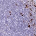TPSB2 Antibody in Immunohistochemistry (Paraffin) (IHC (P))
