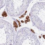 TPSB2 Antibody in Immunohistochemistry (Paraffin) (IHC (P))