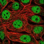 RFXANK Polyclonal Antibody