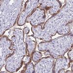TFPI2 Antibody in Immunohistochemistry (Paraffin) (IHC (P))