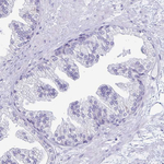 TFPI2 Antibody in Immunohistochemistry (Paraffin) (IHC (P))