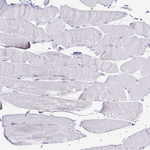 TFPI2 Polyclonal Antibody