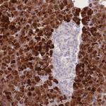 BSSP4 Antibody in Immunohistochemistry (Paraffin) (IHC (P))