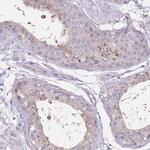 RSPH10B Polyclonal Antibody