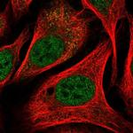 Parp8 Antibody in Immunocytochemistry (ICC/IF)