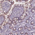 Parp8 Antibody in Immunohistochemistry (IHC)