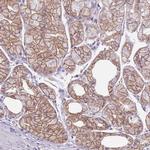 Parp8 Antibody in Immunohistochemistry (IHC)