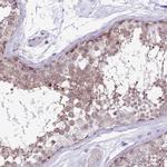 Parp8 Antibody in Immunohistochemistry (IHC)
