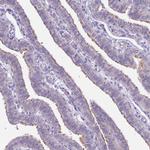 Parp8 Antibody in Immunohistochemistry (IHC)