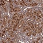 NBEAL1 Antibody in Immunohistochemistry (Paraffin) (IHC (P))