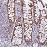 ANO8 Antibody in Immunohistochemistry (Paraffin) (IHC (P))