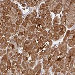 ZNF285 Polyclonal Antibody