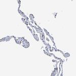 LCLAT1 Antibody in Immunohistochemistry (Paraffin) (IHC (P))