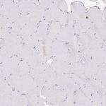 LCLAT1 Antibody in Immunohistochemistry (Paraffin) (IHC (P))