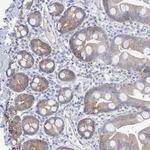 LCLAT1 Polyclonal Antibody