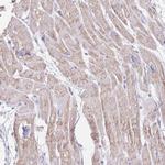 LCLAT1 Antibody in Immunohistochemistry (IHC)
