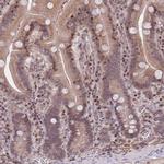 SLC35F5 Polyclonal Antibody