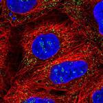 PEX14 Polyclonal Antibody