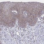 PEX14 Antibody in Immunohistochemistry (IHC)