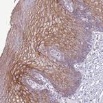 CHAC2 Antibody in Immunohistochemistry (Paraffin) (IHC (P))