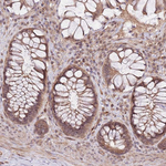 PRR16 Antibody in Immunohistochemistry (Paraffin) (IHC (P))