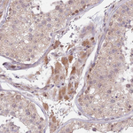 PRR16 Antibody in Immunohistochemistry (Paraffin) (IHC (P))