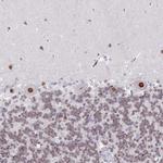 ZNF382 Antibody in Immunohistochemistry (Paraffin) (IHC (P))