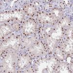 ZNF382 Antibody in Immunohistochemistry (Paraffin) (IHC (P))