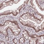 ZNF382 Antibody in Immunohistochemistry (Paraffin) (IHC (P))