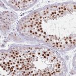 MRPL34 Antibody in Immunohistochemistry (Paraffin) (IHC (P))
