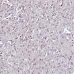 DHX8 Antibody in Immunohistochemistry (Paraffin) (IHC (P))