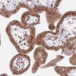 DHX8 Antibody in Immunohistochemistry (Paraffin) (IHC (P))