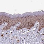DHX8 Antibody in Immunohistochemistry (Paraffin) (IHC (P))