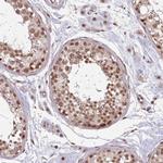 DHX8 Antibody in Immunohistochemistry (Paraffin) (IHC (P))