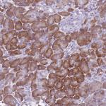 HYOU1 Polyclonal Antibody