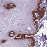 CNPPD1 Polyclonal Antibody