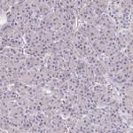 FAM83E Antibody in Immunohistochemistry (IHC)
