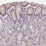 FAM83E Antibody in Immunohistochemistry (IHC)