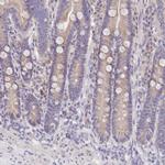 FAM83E Polyclonal Antibody
