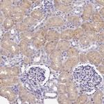 FAM83E Antibody in Immunohistochemistry (IHC)