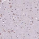 KCTD19 Antibody in Immunohistochemistry (Paraffin) (IHC (P))