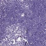 KCTD19 Polyclonal Antibody