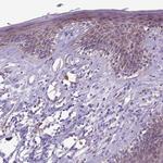 KCTD19 Antibody in Immunohistochemistry (Paraffin) (IHC (P))