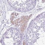 KCTD19 Antibody in Immunohistochemistry (Paraffin) (IHC (P))