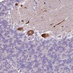 PSRC1 Antibody in Immunohistochemistry (Paraffin) (IHC (P))