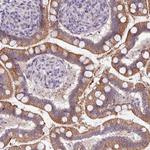 ACAP3 Polyclonal Antibody