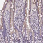 MYRFL Antibody in Immunohistochemistry (Paraffin) (IHC (P))