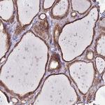 OR52I2 Polyclonal Antibody