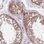 PLD6 Antibody in Immunohistochemistry (Paraffin) (IHC (P))